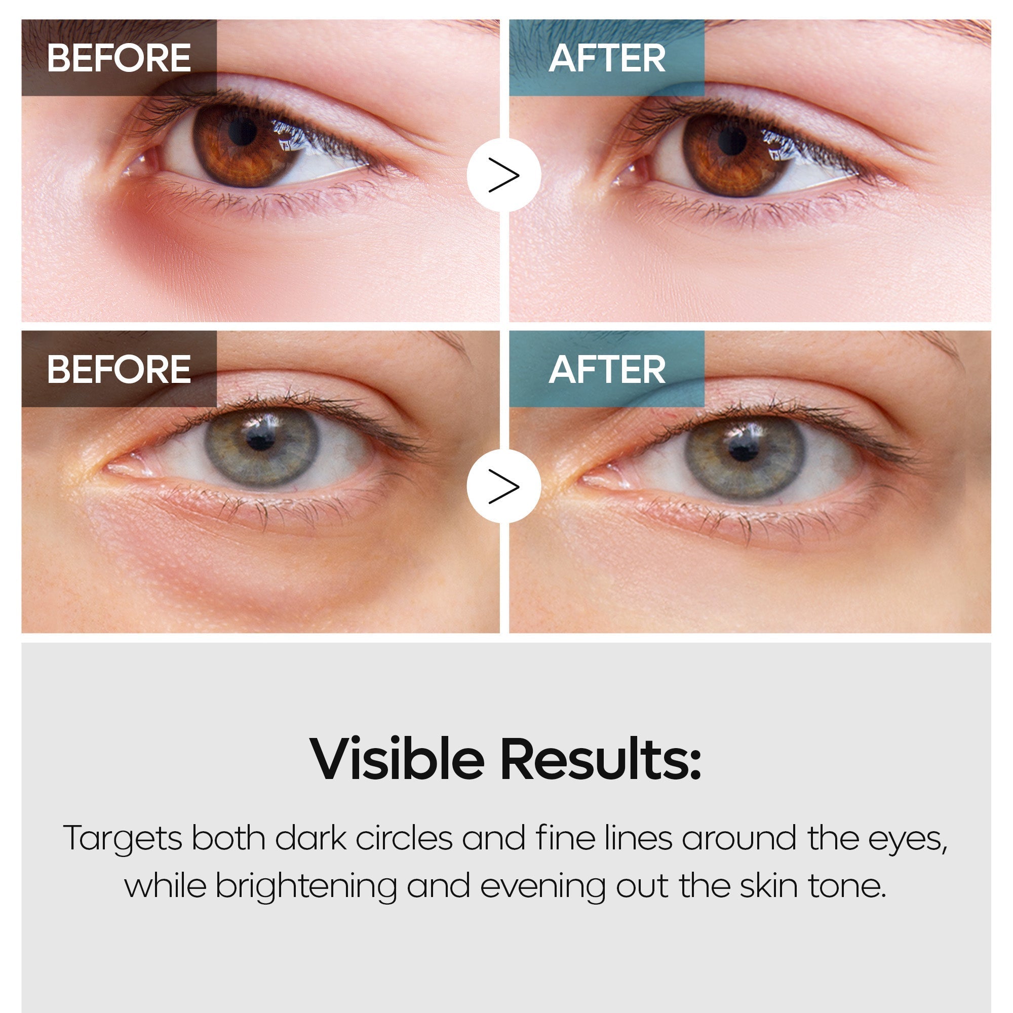 TX Eye Care Toner Set